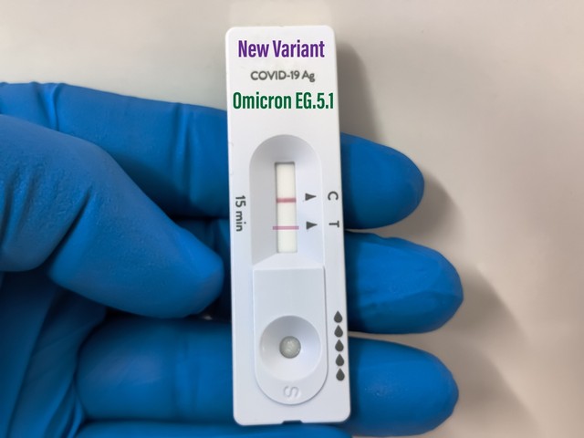 Covid Eris: ezt kell tudni a viszály istennőjéről elnevezett omikron-variánsról