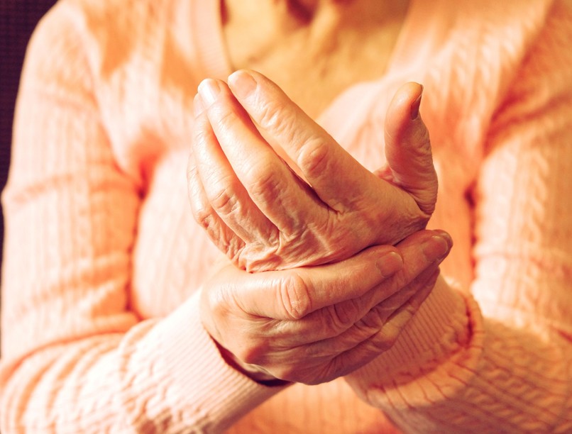 Ízületi gyulladás, idős, nő, érint, veszélyeztet