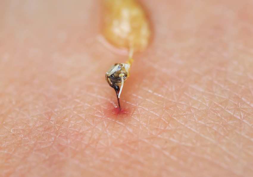 Kedves orvosok! Néhány bejegyzés kapcsán felmerült bennem pár kérdés.