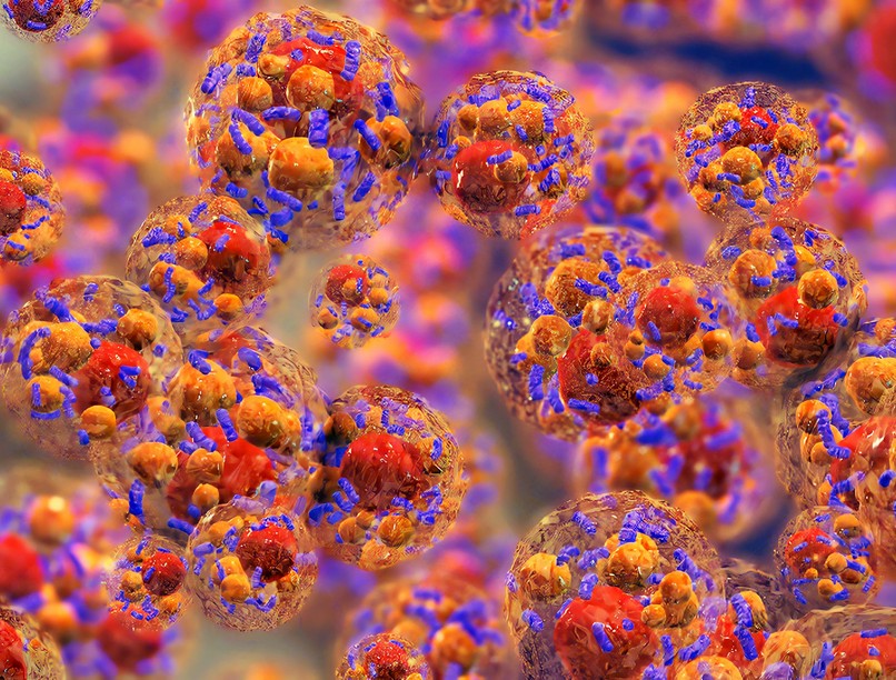 mit tehetünk zsírmáj ellen házi gyógymód gyógytea