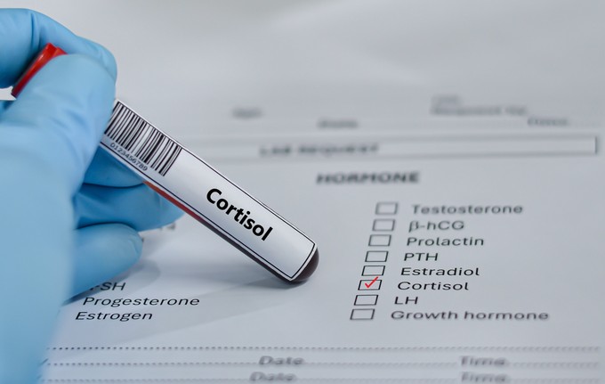 Mi számít magas kortizol szintnek? Nézze meg, érintett-e! című cikk nyitóképe