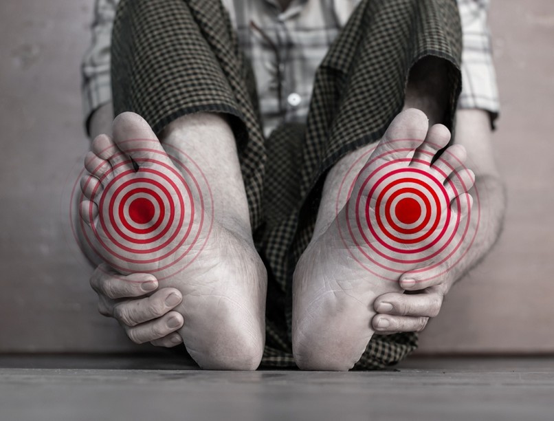 bőrszázaság láb cukorbetegség diabétesz vércukor