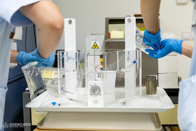 Májdaganat: új, műtét nélküli terápiát alkalmaznak a Semmelweis Egyetemen