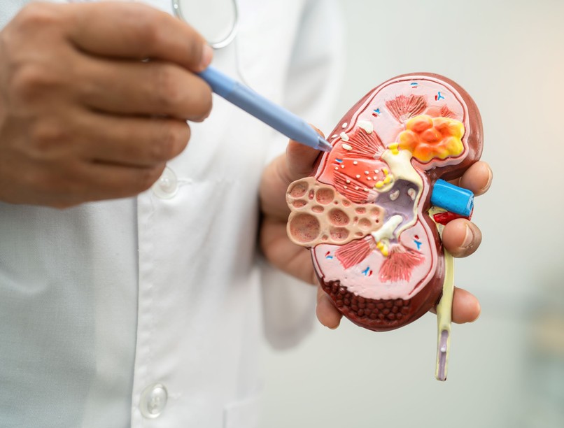 policisztás vesebetegség Mitől alakul ki