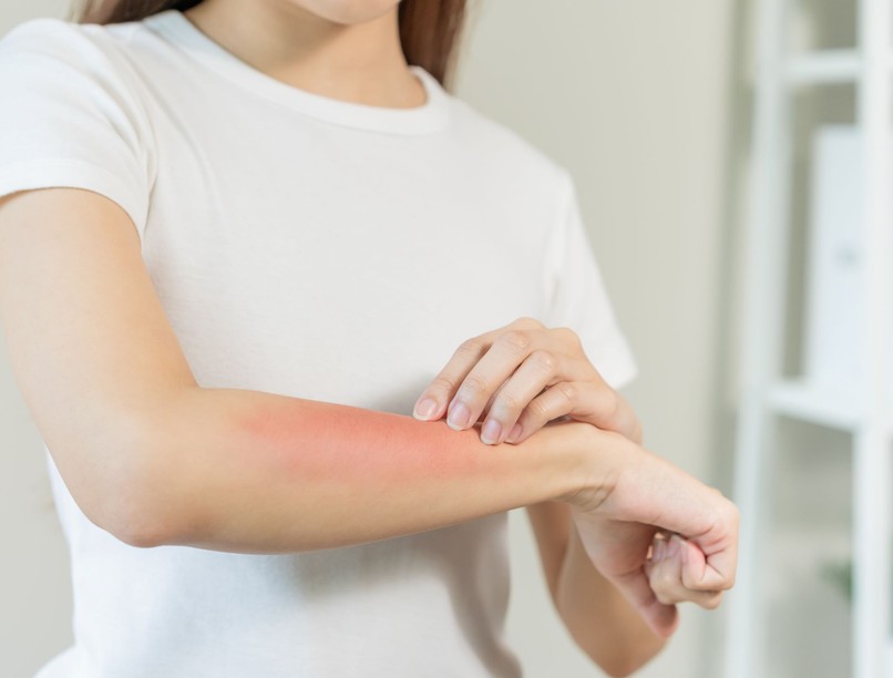 mosópor, allergia, kiütés, viszketés allergén