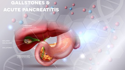 Epekő: oka, kialakulása, tünete és kezelési lehetőségei című cikk nyitóképe