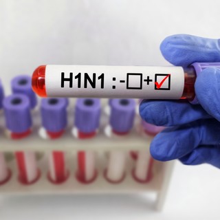 H1N1 (új influenza) tünetei, vizsgálata és kezelése című cikk nyitóképe