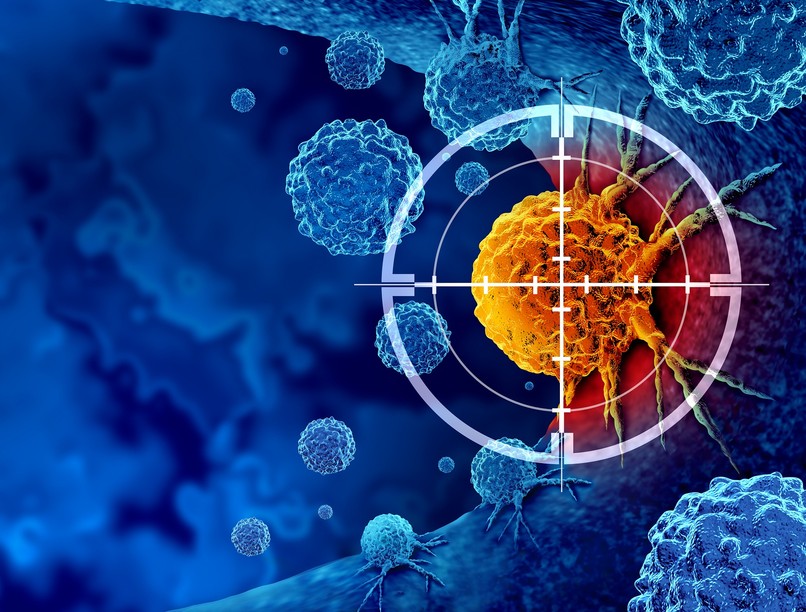 prosztatarák, prosztata daganat, tumor diagnózis, szűrővizsgálat