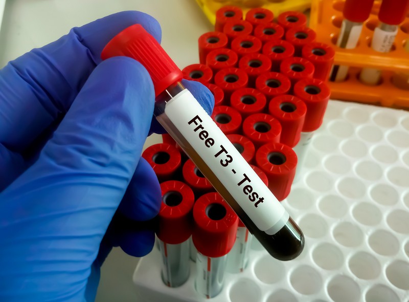 Mit jelent a FT3 (szabad T3) érték a laborleleten?