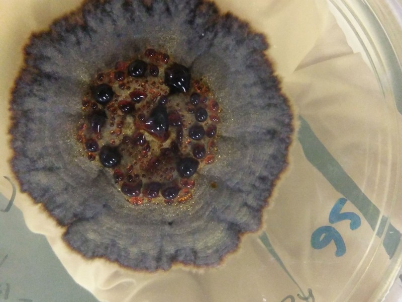 Gombás fertőzés: ilyen súlyos, amikor a belső szerveket érinti!