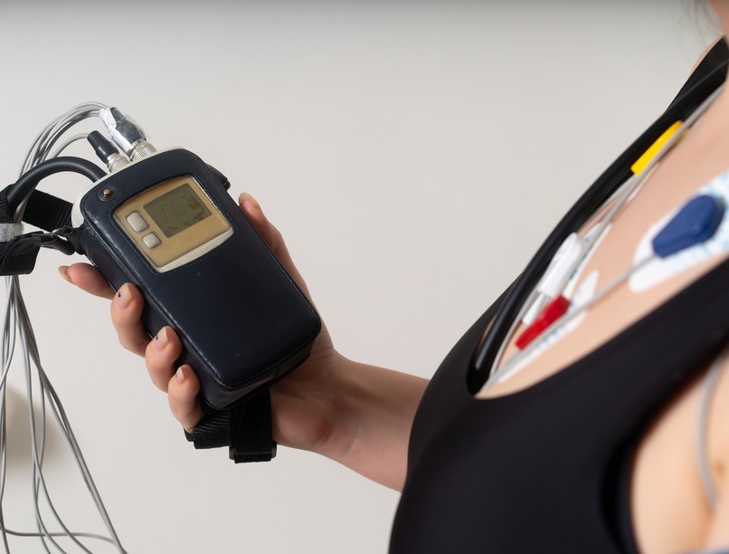 Holter-monitorozás 24 órás EKG vizsgálat leírás