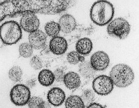Egy különös vírusfertőzésről - miniszterünk betegsége kapcsán