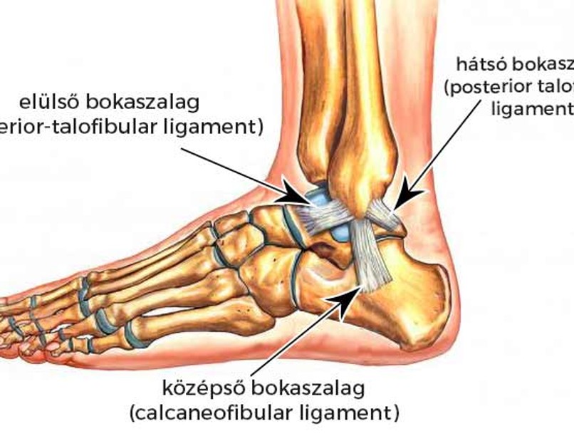 Mi az ínszalagszakadás ruptura ligamenti