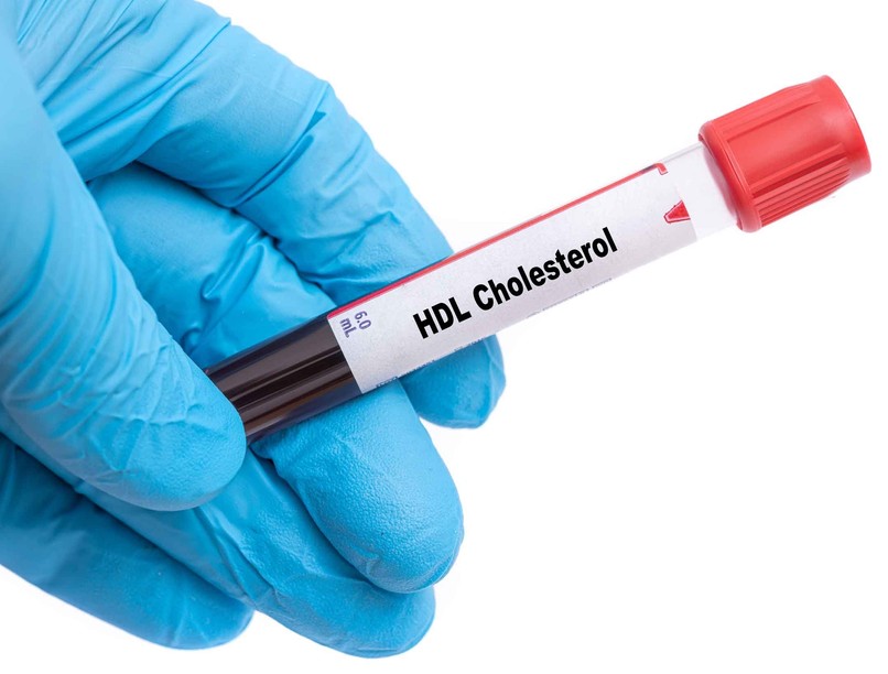 Mit jelent HDL-koleszterin érték laborlelet