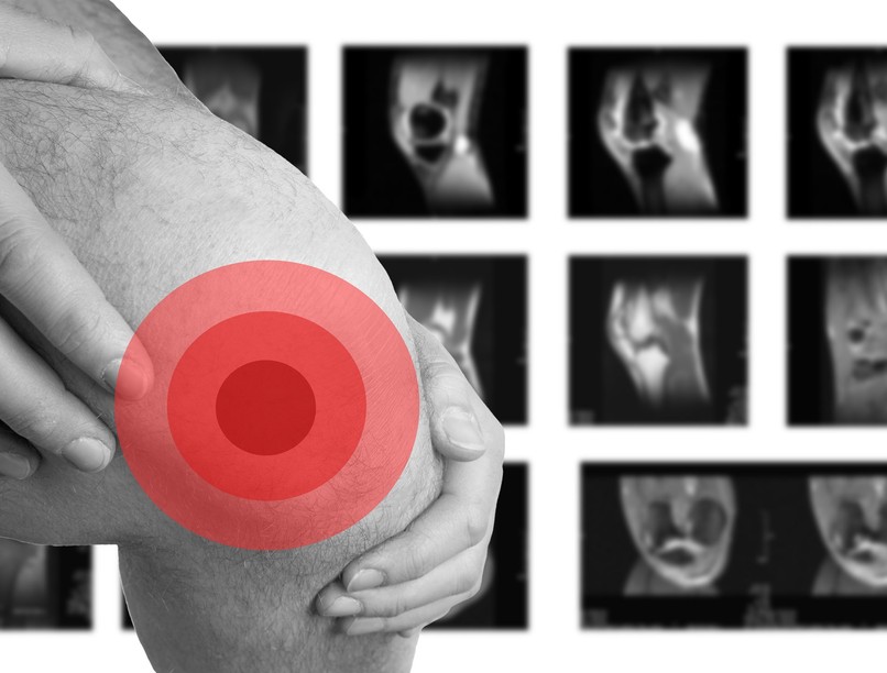 porckopás porcmegújulás ízületi fájdalom