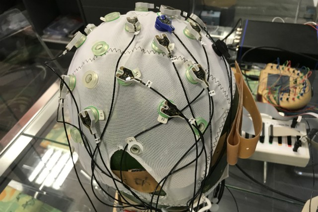 Agyi defibrillátor: megállíthatja az epilepsziás rohamokat