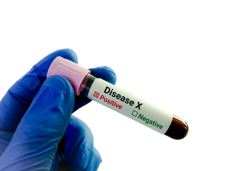 Megállítható-e a határnál a Kongóból kiinduló rejtélyes halálos kór?