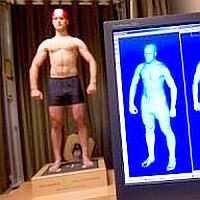 Autoimmun betegségek: kisszótár