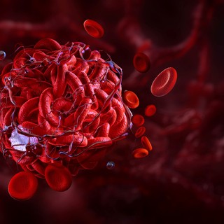 Mi az antikoaguláns kezelés (véralvadásgátló terápia)? című cikk nyitóképe