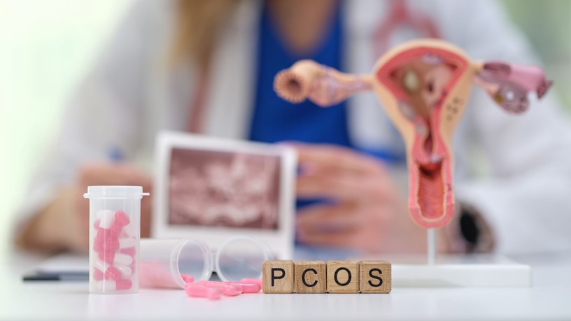 PCOS tünetei kezelése felismerése