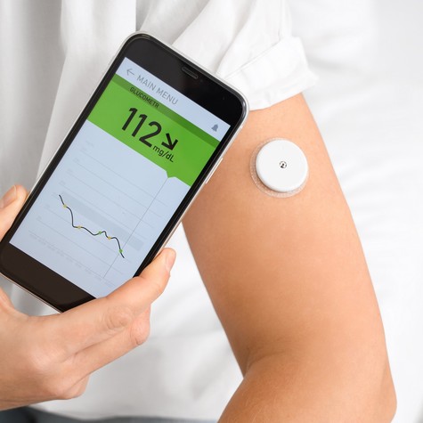 CGM : mit árulnak el a szöveti cukor monitorozással mért értékek? című cikk nyitóképe