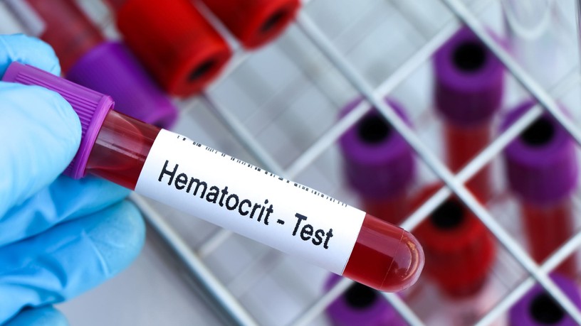 hematokrit, htc, alacsony, magas mit jelent