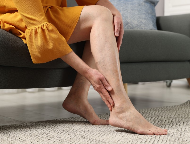 visszér, ne,  tilos, kerül, véna