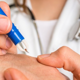 Lyme-kór fertőzés: ezekkel a betegségekkel keverhetők össze a tünetei című cikk nyitóképe