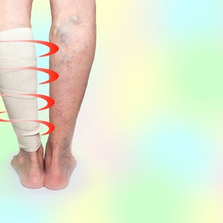 Vénafalgyulladás (tromboflebitisz): okai, tünetei, kezelése és megelőzése című cikk nyitóképe