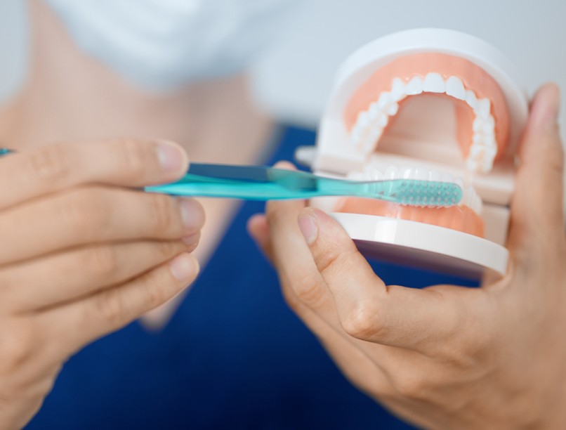 fogászati problémák, demencia, elbutulás, alzheimer-kór