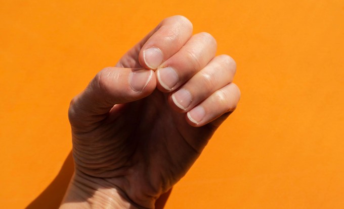Egy sötét csík, egy furcsa forma – 5 jel, amikor a körmök daganatra figyelmeztetnek című cikk nyitóképe
