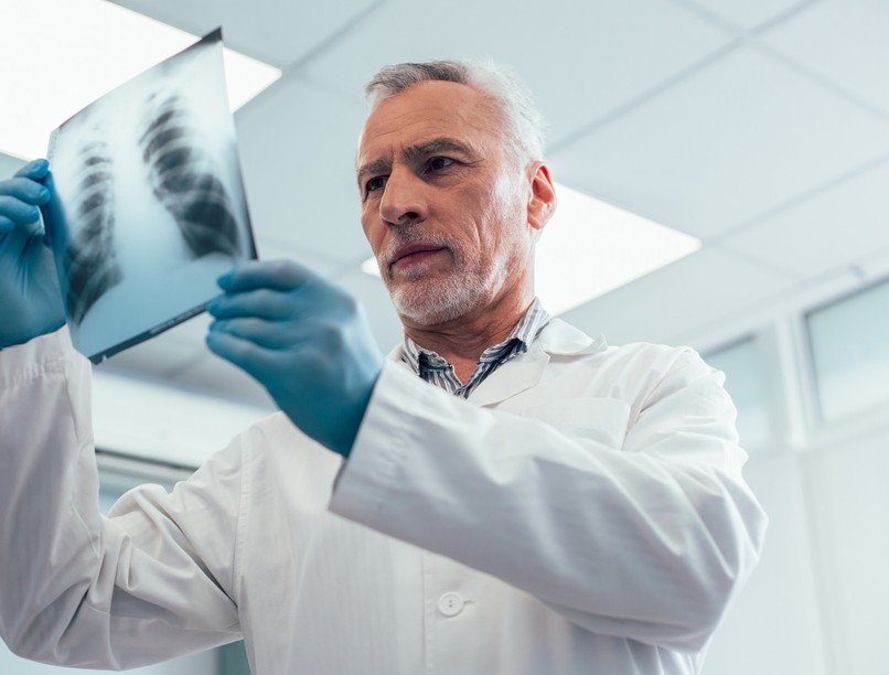 mellkasröntgen, tüdő, szív