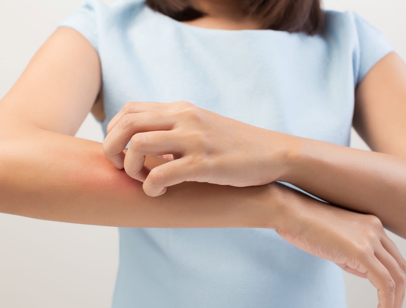 Bőrviszketés okai és kezelése
