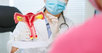 PCOS-re fogamzásgátló: mi működhet még, ha a családtervezés a tét?