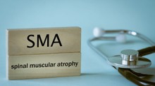 Elérhetővé vált az otthon alkalmazható SMA-terápia című cikk nyitóképe
