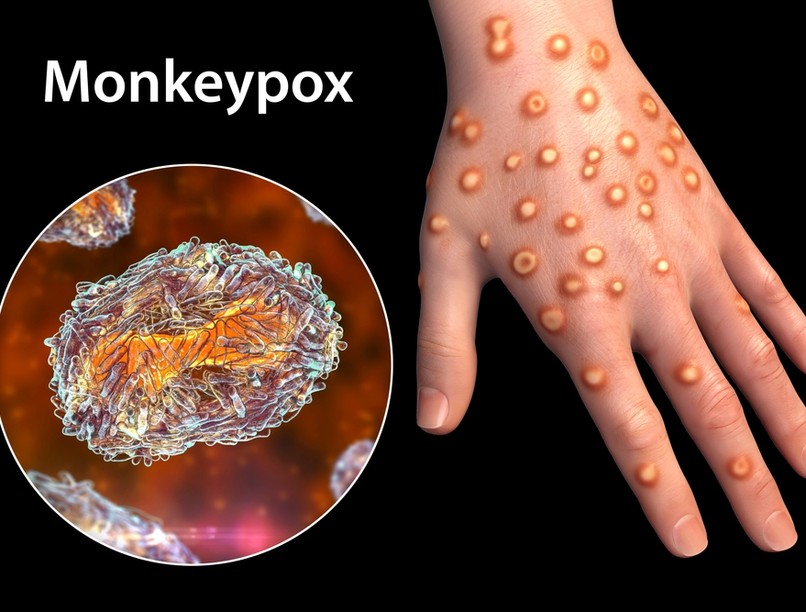 majomhimlő, Magyarország, terjedése, tünetei