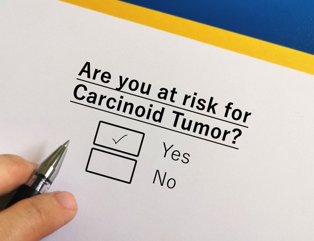 Karcinoid tumorok: tünetek, okok, kezelési lehetősgek