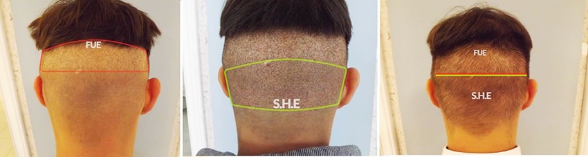 Fue és SHE módszer összehasonlítása