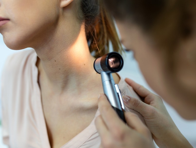 anyajegy elváltozás bőrgyógyász abcd szabály