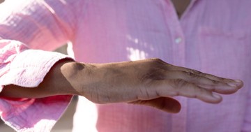 Nem a kézremegés az első jel: 4 Parkinson-tünet, ami évekkel a diagnózis előtt jelentkezhet