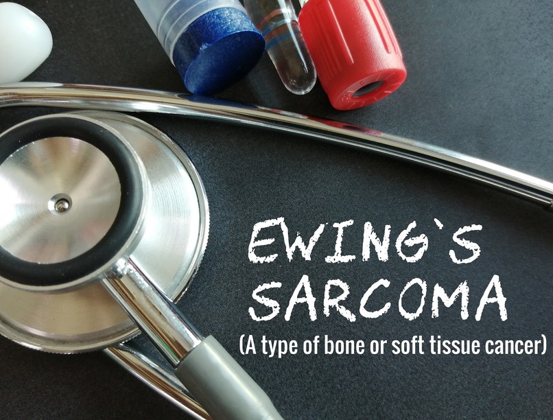 Ewing-szarkóma