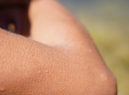 Miért leszünk libabőrösek egy megható pillanattól? Ez történik a testünkben című cikk nyitóképe