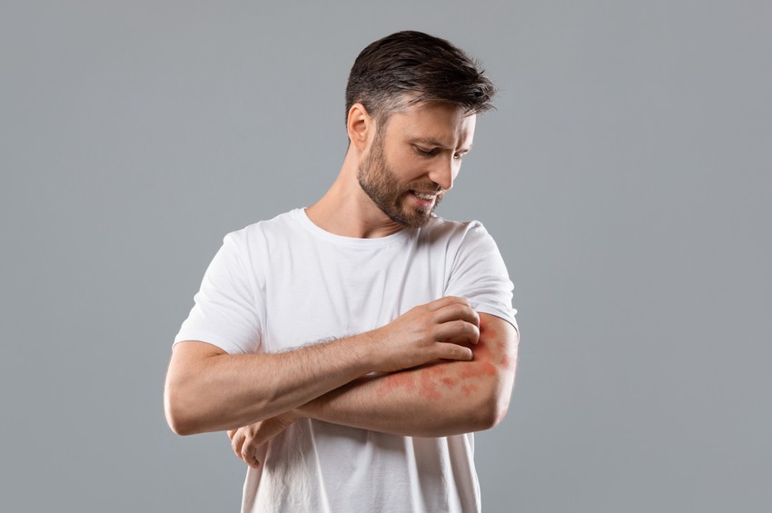 A leggyakoribb bőrproblémák