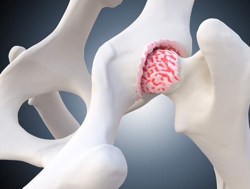 porckopás jele oka kezelése műtét