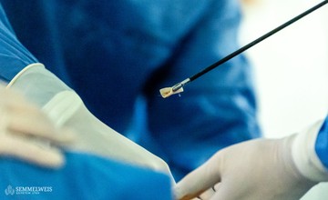 3 petefészek szövetet ültettek vissza a beteg szervezetébe laparoszkópós eljárással. 