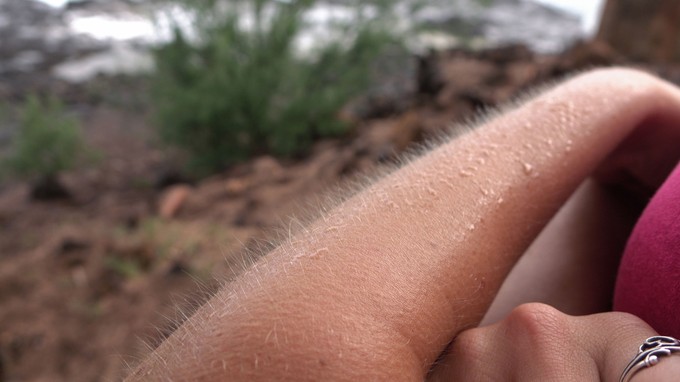 Ez az oka annak, hogy libabőrösök leszünk bizonyos helyzetekben című cikk nyitóképe