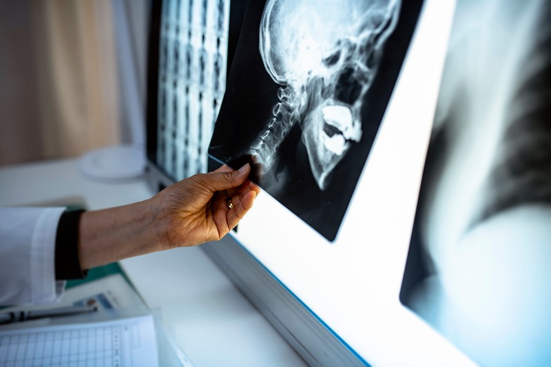 A házaspár beperelte a kórházat, miután elvesztették a férfi koponyájának egy részét