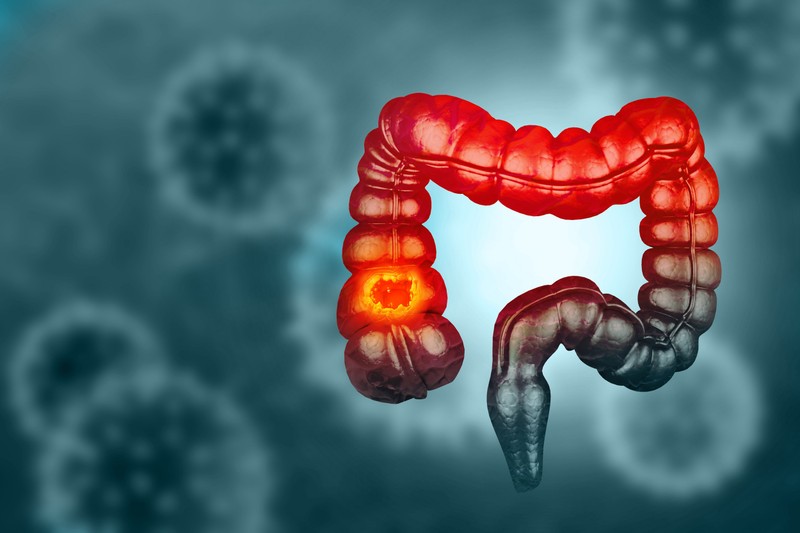 Kisvárosnyi magyar hal meg ebben a betegségben! Elkerülheti a nagy bajt, ha erre figyel