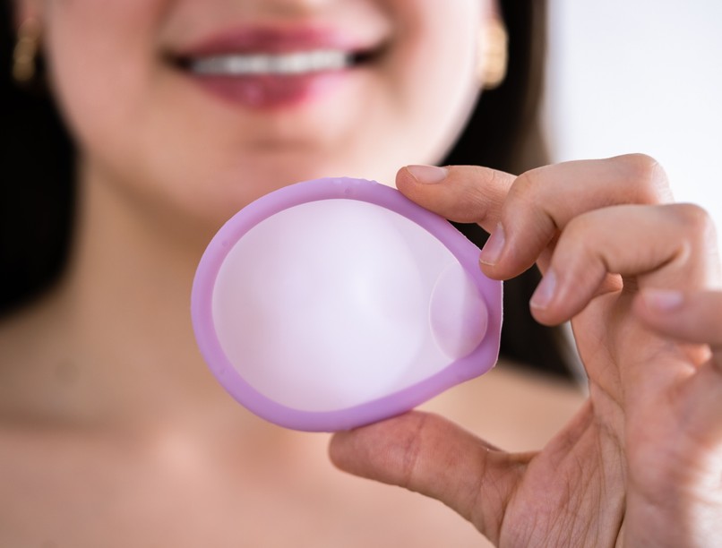 fogamzásgátló pesszárium méhsüllyedés nőgyógyász inkontinencia