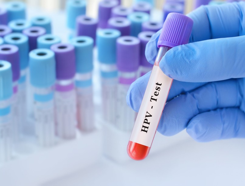 méhnyakrák szűrés HPV citológia orvos válaszol